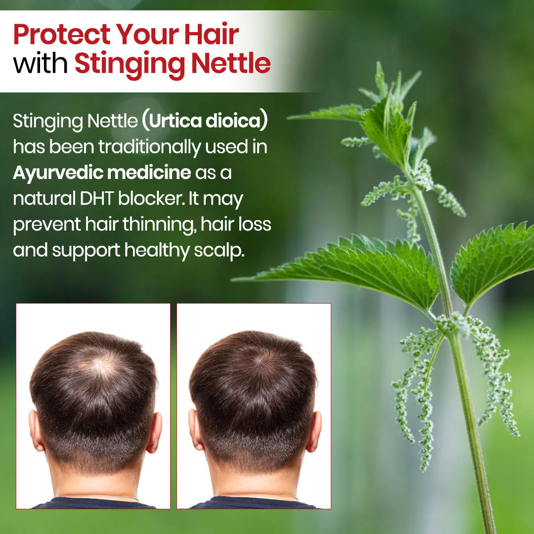 Himalayan Organics, DHT Blocker with Biotin Nettle Leaves 